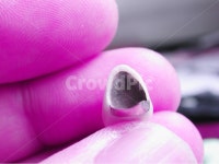 치과, 의료, 보철, 치과기공사, 기공사, 사진,이미지,일러스트,캘리그라피 - SeeOn작가 크라우드픽 - 저작권 걱정 없는 상업용 이미지