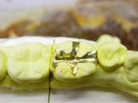 치과, 의료, 치과기공사, 인레이, inlay, 사진,이미지,일러스트,캘리그라피 - SeeOn작가 크라우드픽 - 저작권 걱정 없는 상업용 이미지