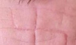 Sick images show swastikas carved into Ukrainian POWs faces by Putins troops | World | News | Express.co.uk Sick images show... 