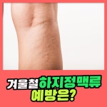겨울철 하지정맥류를 예방하기 위해서는 : 건강검진정보