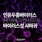 인유두종바이러스(HPV)감염에 의한 사마귀. 바이러스성 사마귀 : 건강검진정보 인유두종바이러스(HPV)감염에 의한 사마귀. 바이러스성 사마귀... 