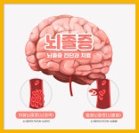겨울뿐 아니라 여름철에도 조심해야 하는 뇌졸중 : 건강검진정보
