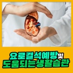 요로결석 및 재발 방지에 도움되는 생활습관 : 건강검진정보