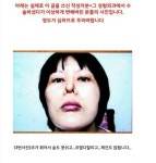 아래 글 사이코패스의사 성형 피해자들 사진 (심약자 주의!) - 인스티즈(instiz) 이슈 카테고리 아래 글 사이코패스의사 성형 피해자들 사진... 