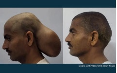 머리가 두개? 15년간 뒤통수에서 자란 이것, 정체는? / 다른 채소보다 이것 더 잘 씻어야...대장균 증식 빨라 / 이 잘 닦아도 고약한 입냄새...... 