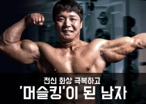전신 화상 극복하고 머슬킹이 된 남자 조형원의 대포알 팔 운동 3... 전신 화상 극복하고 머슬킹이 된 남자 조형원의 대포알 팔 운동 3