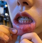 대전 봉명동 20대 여성에게 가해진 충격적인 무차별 폭행 수준 < 사회... 대전 봉명동 20대 여성에게 가해진 충격적인 무차별 폭행 수준