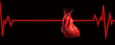 3,000+ Free Cardiac Monitor & Monitor Images - Pixabay