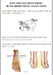 장코치 근육학. 장요근/대둔근의 길항작용과 햄스트링과활성화로 인한 둔근 complex의 기능부전 - 뽐뿌:건강/헬스 장코치 근육학. 장요근... 