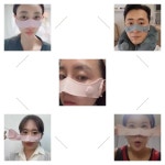 아이엠미세전류전문에스테닉 | [6만원대/10일 완성] 미세전류로 나비존 집중관리, 모든게 달라집니다. by 더비거(THE VIGGOR)