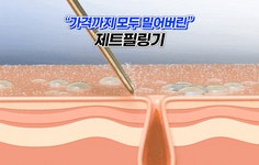 각질 날리고, 수분은 채워 탱탱- 유리알 피부! 5만원대 제트필링기 by 주식회사 큐비스트