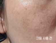[임상완료] 순수비타민C 25% 고농축 비타민크림 by 어업회사법인 주식회사 이노플럭스 | wadiz [임상완료] 순수비타민C 25% 고농축 비타민크림... 