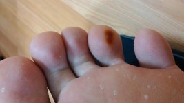 발이 이상합니다 - 뽐뿌:질문/요청 발이 이상합니다