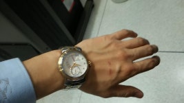 시계 구매했는데 용두로 손등을 계속 치게 되서 아파요... - 뽐뿌:시계포럼 시계 구매했는데 용두로 손등을 계속 치게 되서 아파요...