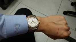 시계 구매했는데 용두로 손등을 계속 치게 되서 아파요... - 뽐뿌:시계포럼 시계 구매했는데 용두로 손등을 계속 치게 되서 아파요...