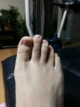 중2 딸 발을 보니 엄지발가락이 유난히 짧네요. 이거 [약혐] - 뽐뿌:자유게시판 중2 딸 발을 보니 엄지발가락이 유난히 짧네요. 이거 [약혐]
