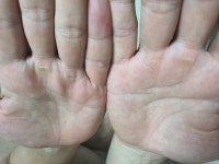 굳은살 방지 좋은 장갑 없을까요? - 뽐뿌:건강/헬스 굳은살 방지 좋은 장갑 없을까요?