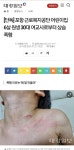 포항 난리났습니다 (어린이집 여교사 아이 폭행) - 뽐뿌:자유게시판 포항 난리났습니다 (어린이집 여교사 아이 폭행)