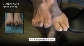 한의원 침 치료 위엄 ㄷㄷ.jpg - 뽐뿌:자유게시판 한의원 침 치료 위엄 ㄷㄷ.jpg