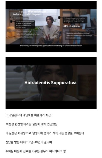 희귀병을 앓고 있다는 사실을 고백한 이홍기 ㄷ..JPG - 뽐뿌:자유게시판 희귀병을 앓고 있다는 사실을 고백한 이홍기 ㄷ..JPG