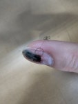 손톱 중간에 금가면 - 뽐뿌:자유게시판 손톱 중간에 금가면
