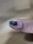 손톱 중간에 금가면 - 뽐뿌:자유게시판 손톱 중간에 금가면