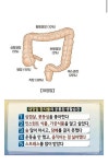 대장암환자들의 공통된 습관 - 뽐뿌:자유게시판  대장암환자들의 공통된 습관