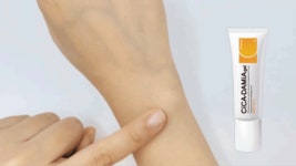 주식회사 에이앤케이메디칼 | [전문 흉터관리 의료기기] 흉터고민 의료용 흉터연고로 흉터 케어하세요. by 주식회사에이앤케이메디칼