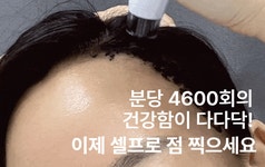 [2억앵콜]단1회! 분당4600샷! 3분이면 채워지는 민둥두피 반전드라마 by 주식회사 씨앤케이랩