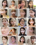 [6만원대/10일 완성] 미세전류로 나비존 집중관리, 모든게 달라집니다.