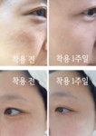 아이엠미세전류전문에스테닉 | [6만원대/10일 완성] 미세전류로 나비존 집중관리, 모든게 달라집니다.