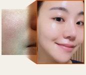 [경희한의원 입점] 400년 율무크림, 울퉁불퉁 요철들 7일안에 삭제해요 by 마미케어