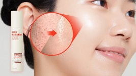 주식회사 니들워커 | 모공에 쏘는 40만니들샷! Y자모공 꽉 쪼여요 360º회전니들 MTS크림 by 주식회사 어댑트