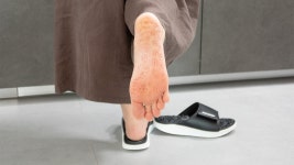 [한의사 제작 참여] 부끼톡스 슬리퍼, 신고 걸으면 마사지+스트레칭 효과 by 주식회사 오림코퍼레이션