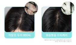이젠 두피도 1일 1팩 샴푸로 #탈모케어 by 주식회사 와이에이치인터내셔널 | wadiz 펩타이드9종, 아직도 얼굴에만? 이젠 두피도 1일 1팩 샴푸로... 