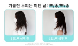 펩타이드9종, 아직도 얼굴에만? 이젠 두피도 1일 1팩 샴푸로 #탈모케어 by 주식회사 와이에이치인터내셔널