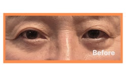 이름부터 [아이써마]가 아이백, 이번엔 진짜 해결해 드립니다.ㅣ3CP