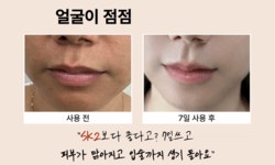 피테라보다 3배 맑아져? 와.. 엄청 하얘지고 입술까지 붉어져 깜짝 놀람 by 더마네이처코스메틱(주)