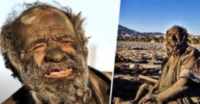 70년 가까이 안 씻고 썩은 동물 사체만 먹은 남성... 정말 엄청난 근황 전해졌다 | 위키트리 70년 가까이 안 씻고 썩은 동물 사체만 먹은 남성...... 