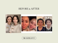 [코코뷰티 [인셀덤]]