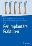 Periimplantaere Frakturen | Hildebrand, Frank - 교보문고