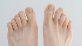 손톱, 발톱 색깔, 모양으로 알아보는 건강 상태와 매니큐어 부작용까지 🫱 | 나에게 딱 맞는 건강 꿀팁