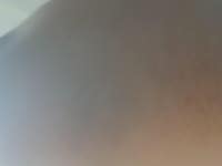 몸에 멍이나 흉터많은 여자 별로야? - 오늘학교 커뮤니티