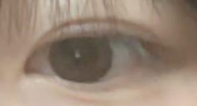 다이어트를 해야하는 이유 - 오늘학교 커뮤니티