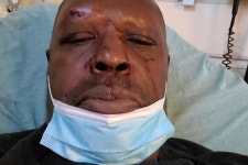 Fundraiser for Oscar Best by Joan Chimento : Oscar go fund me Donate to Oscar go fund me, organized by Joan Chimento