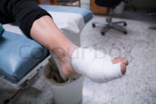 Broken leg with bandage | Stock image | Colourbox