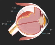 실명까지 유발하는 망막박리의 전조증상부터 종류, 치료법까지 알아보기 - 닥터나우 실명까지 유발하는 망막박리의 전조증상부터 종류... 