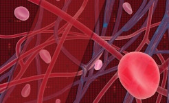 혈관종 제거 꼭 해야 할까? 혈관종 원인, 치료, 증상에 대해 파헤치기 - 닥터나우 혈관종 제거 꼭 해야 할까? 혈관종 원인, 치료, 증상에 대해... 