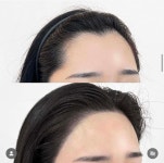 블라인드 | 블라블라: 헤어라인문신 블라블라: 헤어라인문신