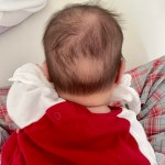 블라인드 | 육아: 신생아 뒤통수 머리빠짐 육아: 신생아 뒤통수 머리빠짐